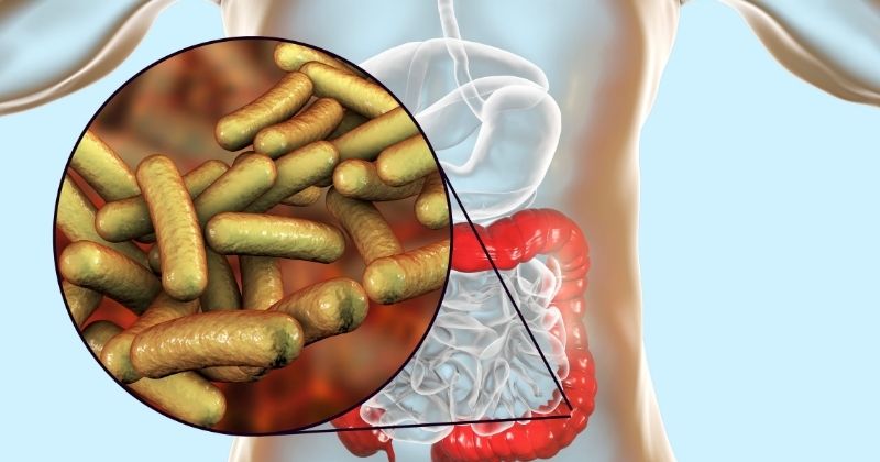 Kiết Lỵ Là Gì? Dấu Hiệu Trực Quan, Nguyên Nhân Và Cách Chữa Trị Triệt Để 4 5 Dấu Hiệu Nhận Biết Sớm Bạn Đã Bị Kiết Lỵ