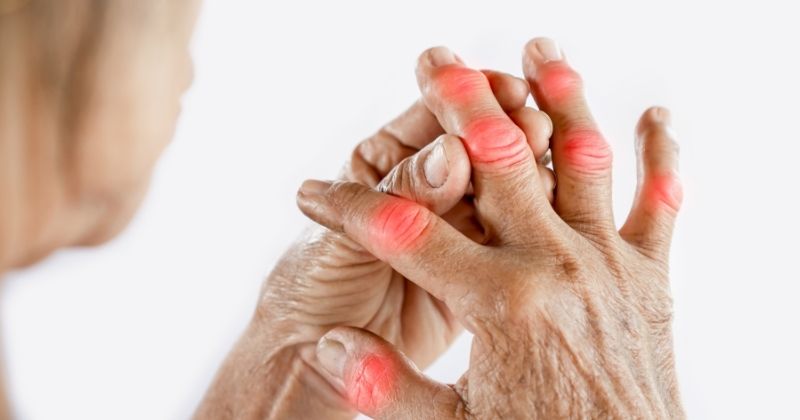 Cách Chữa Bệnh Gút Giai Đoạn Đầu